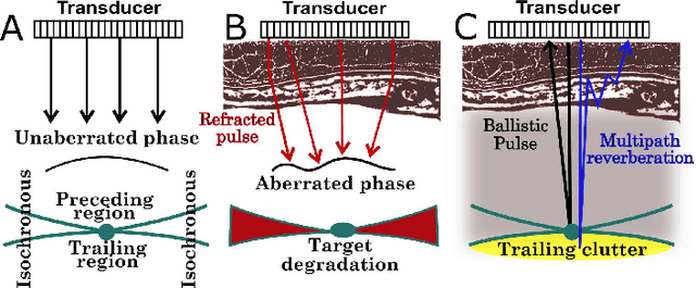 Figure 1 for Deconstruction and reconstruction of image-degrading effects in the human abdomen using Fullwave: phase aberration, multiple reverberation, and trailing reverberation