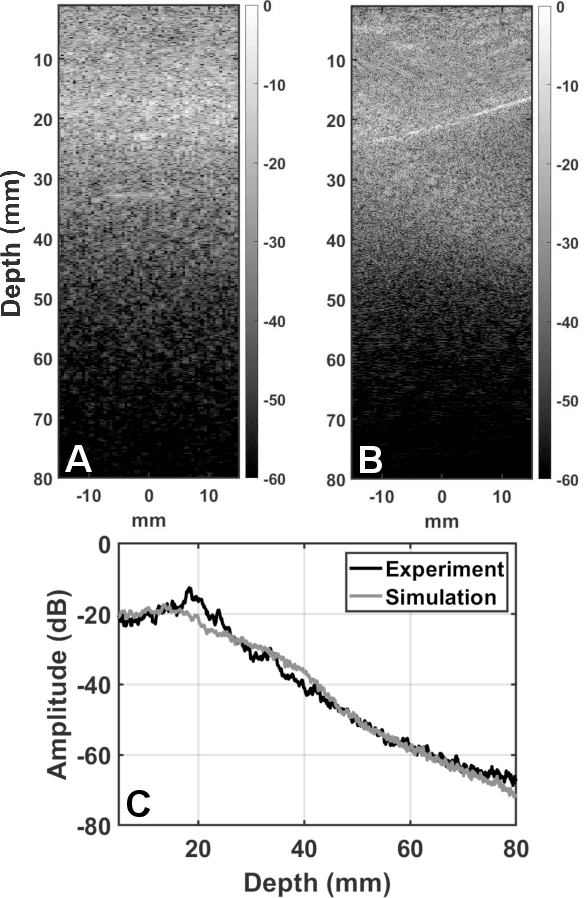 Figure 3 for Deconstruction and reconstruction of image-degrading effects in the human abdomen using Fullwave: phase aberration, multiple reverberation, and trailing reverberation