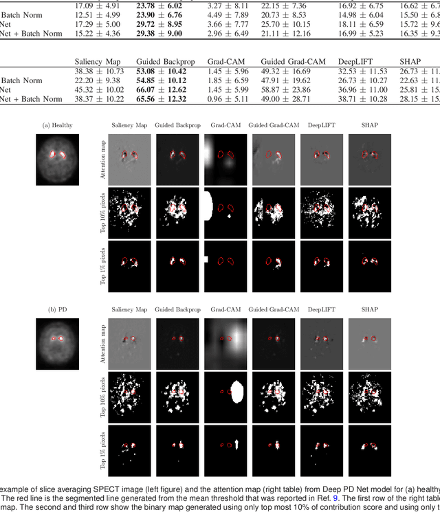 Figure 2 for A comparative study for interpreting deep learning prediction of the Parkinson's disease diagnosis from SPECT imaging