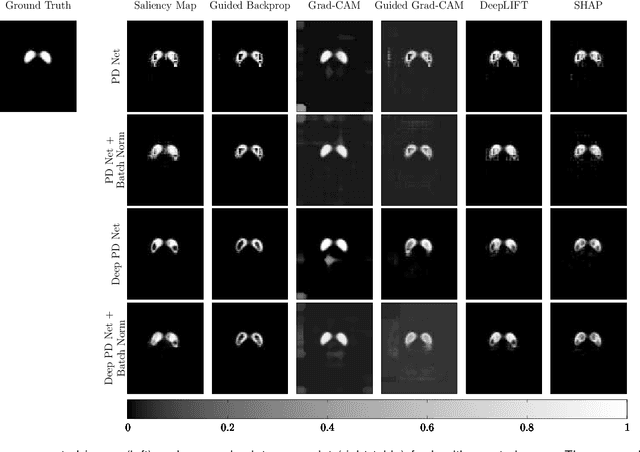 Figure 4 for A comparative study for interpreting deep learning prediction of the Parkinson's disease diagnosis from SPECT imaging