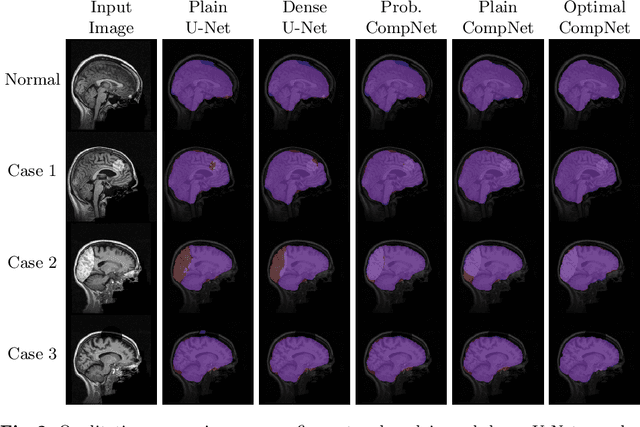 Figure 3 for CompNet: Complementary Segmentation Network for Brain MRI Extraction