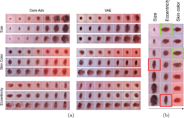 Figure 1 for Learning Interpretable Disentangled Representations using Adversarial VAEs