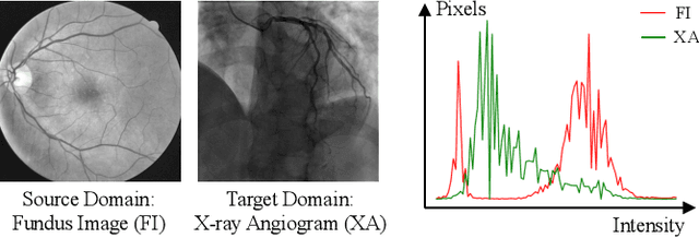 Figure 1 for SS-CADA: A Semi-Supervised Cross-Anatomy Domain Adaptation for Coronary Artery Segmentation