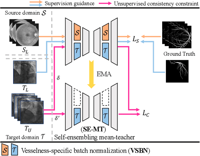 Figure 3 for SS-CADA: A Semi-Supervised Cross-Anatomy Domain Adaptation for Coronary Artery Segmentation