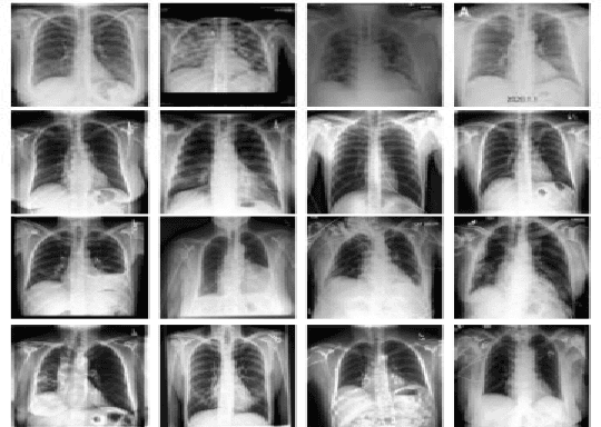 Figure 1 for Automatic Detection of COVID-19 and Pneumonia from Chest X-Ray using Deep Learning