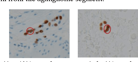 Figure 1 for GanglionNet: Objectively Assess the Density and Distribution of Ganglion Cells With NABLA-N Network