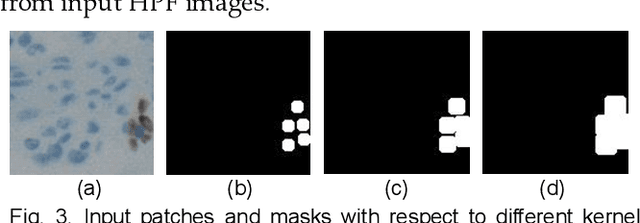 Figure 4 for GanglionNet: Objectively Assess the Density and Distribution of Ganglion Cells With NABLA-N Network