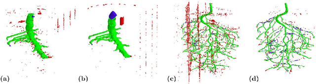 Figure 4 for 3D U-Net for Segmentation of Plant Root MRI Images in Super-Resolution