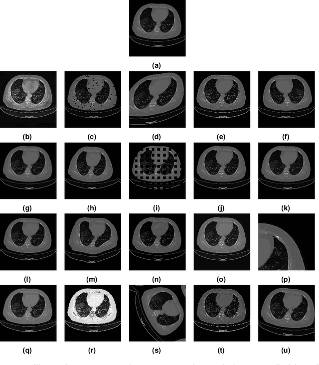 Figure 1 for Light In The Black: An Evaluation of Data Augmentation Techniques for COVID-19 CT's Semantic Segmentation