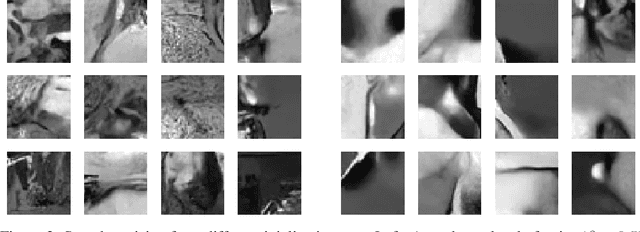 Figure 2 for Solving Linear Inverse Problems Using the Prior Implicit in a Denoiser