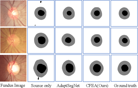Figure 4 for CFEA: Collaborative Feature Ensembling Adaptation for Domain Adaptation in Unsupervised Optic Disc and Cup Segmentation