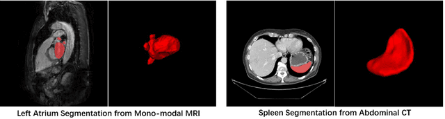 Figure 1 for Exploring Efficient Volumetric Medical Image Segmentation Using 2.5D Method: An Empirical Study