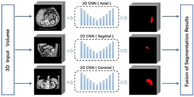 Figure 3 for Exploring Efficient Volumetric Medical Image Segmentation Using 2.5D Method: An Empirical Study