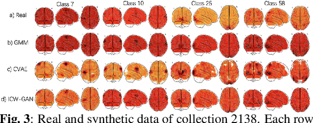 Figure 4 for FMRI data augmentation via synthesis