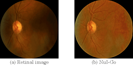 Figure 1 for NuI-Go: Recursive Non-Local Encoder-Decoder Network for Retinal Image Non-Uniform Illumination Removal