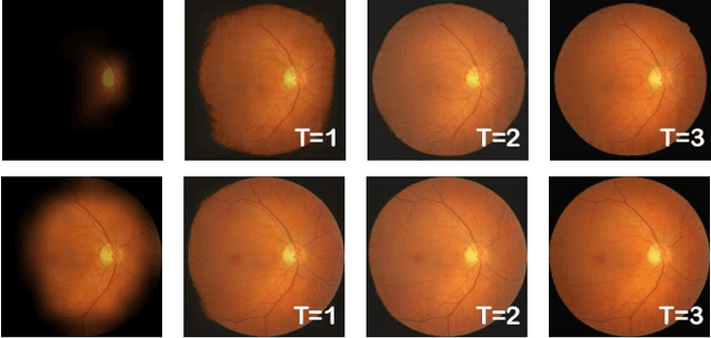 Figure 4 for NuI-Go: Recursive Non-Local Encoder-Decoder Network for Retinal Image Non-Uniform Illumination Removal