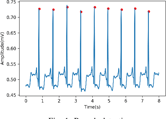 Figure 1 for End-to-End Optimized Arrhythmia Detection Pipeline using Machine Learning for Ultra-Edge Devices