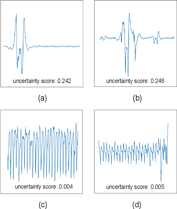 Figure 4 for BayesBeat: A Bayesian Deep Learning Approach for Atrial Fibrillation Detection from Noisy Photoplethysmography Data