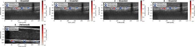 Figure 2 for A Human-Centered Machine-Learning Approach for Muscle-Tendon Junction Tracking in Ultrasound Images