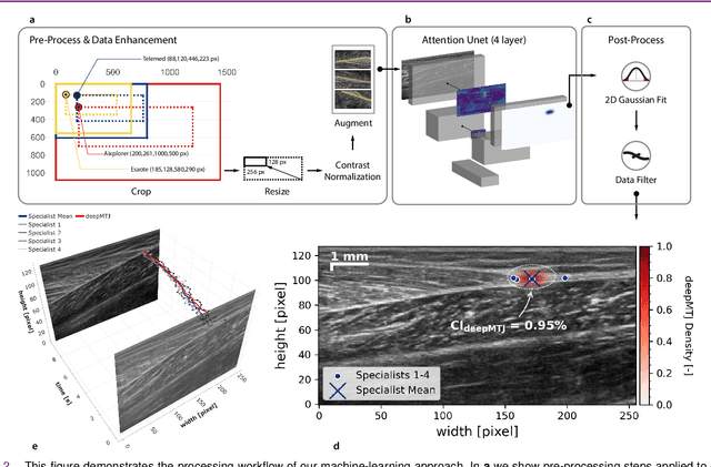 Figure 3 for A Human-Centered Machine-Learning Approach for Muscle-Tendon Junction Tracking in Ultrasound Images