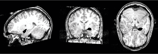 Figure 2 for Introduction to Brain and Medical Images