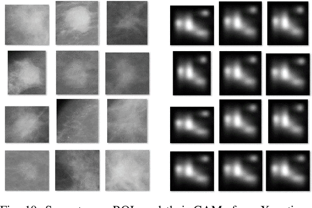 Figure 2 for A Sneak Attack on Segmentation of Medical Images Using Deep Neural Network Classifiers