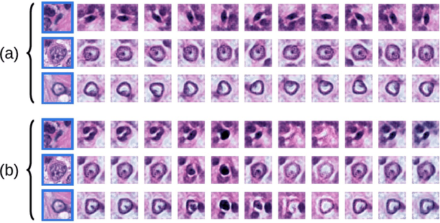 Figure 3 for Orientation-Disentangled Unsupervised Representation Learning for Computational Pathology
