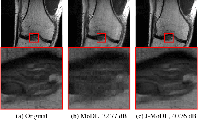 Figure 3 for Joint Optimization of Sampling Patterns and Deep Priors for Improved Parallel MRI