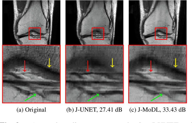 Figure 4 for Joint Optimization of Sampling Patterns and Deep Priors for Improved Parallel MRI