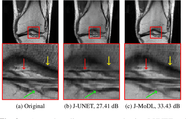 Figure 4 for Joint Optimization of Sampling Patterns and Deep Priors for Improved Parallel MRI