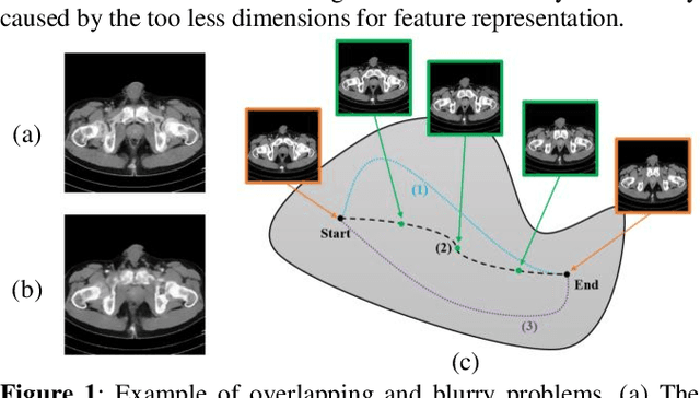 Figure 1 for HRINet: Alternative Supervision Network for High-resolution CT image Interpolation