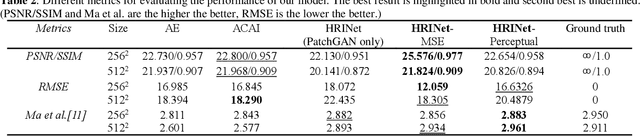 Figure 4 for HRINet: Alternative Supervision Network for High-resolution CT image Interpolation