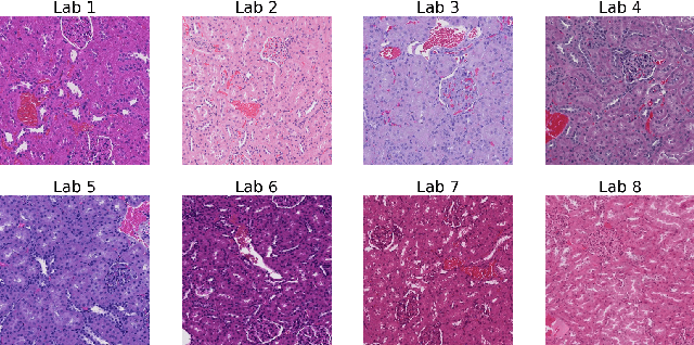Figure 1 for Histopathological Stain Transfer using Style Transfer Network with Adversarial Loss