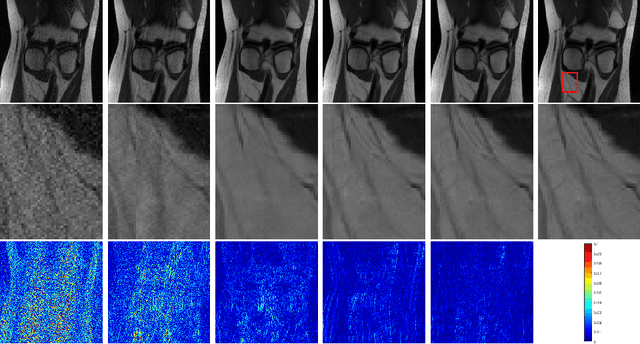 Figure 4 for Deep Parallel MRI Reconstruction Network Without Coil Sensitivities