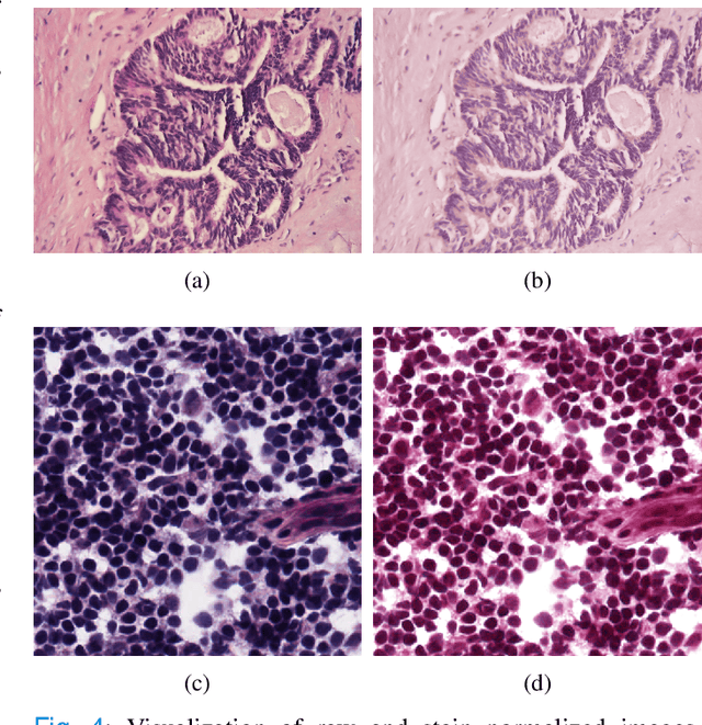 Figure 4 for LEFM-Nets: Learnable Explicit Feature Map Deep Networks for Segmentation of Histopathological Images of Frozen Sections