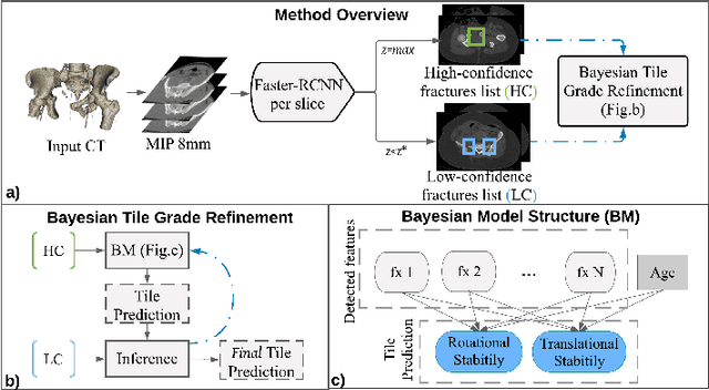 Figure 1 for An Interpretable Approach to Automated Severity Scoring in Pelvic Trauma