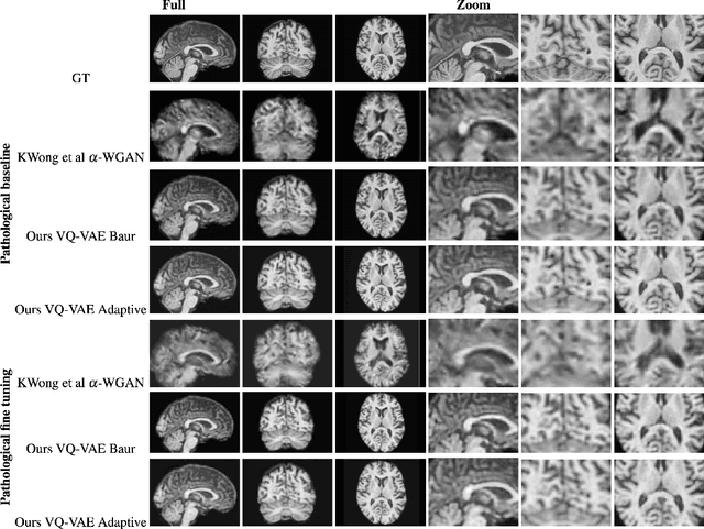 Figure 3 for Neuromorphologicaly-preserving Volumetric data encoding using VQ-VAE