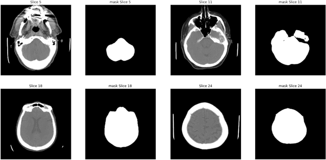 Figure 3 for "Name that manufacturer". Relating image acquisition bias with task complexity when training deep learning models: experiments on head CT