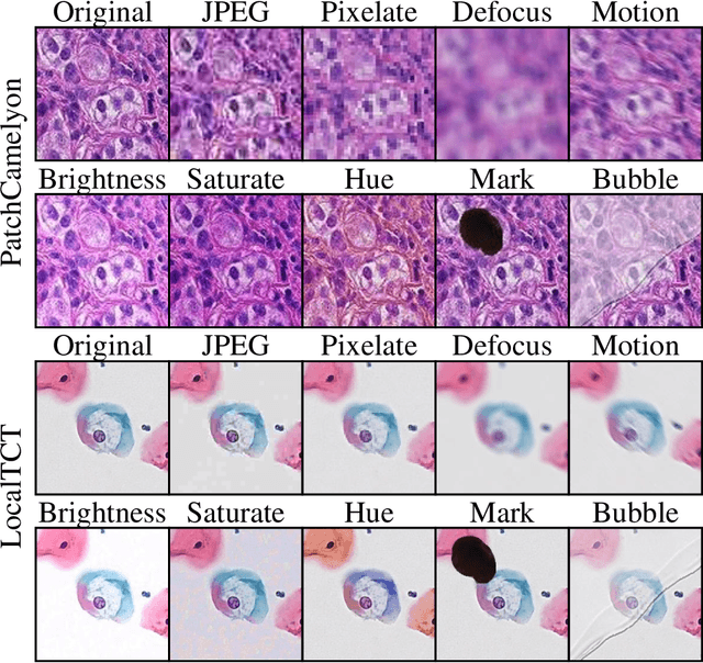 Figure 1 for Benchmarking the Robustness of Deep Neural Networks to Common Corruptions in Digital Pathology