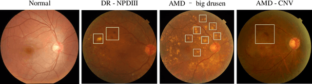 Figure 1 for Synergic Adversarial Label Learning with DR and AMD for Retinal Image Grading