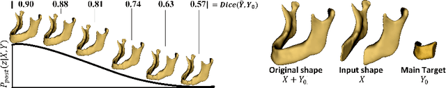 Figure 3 for Variational Mandible Shape Completion for Virtual Surgical Planning