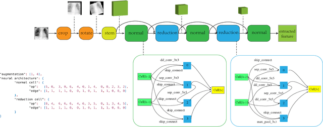 Figure 2 for Auto Machine Learning for Medical Image Analysis by Unifying the Search on Data Augmentation and Neural Architecture