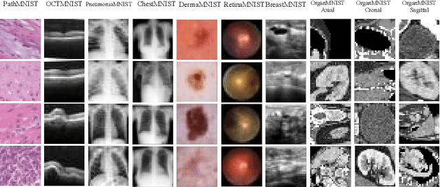 Figure 3 for Auto Machine Learning for Medical Image Analysis by Unifying the Search on Data Augmentation and Neural Architecture