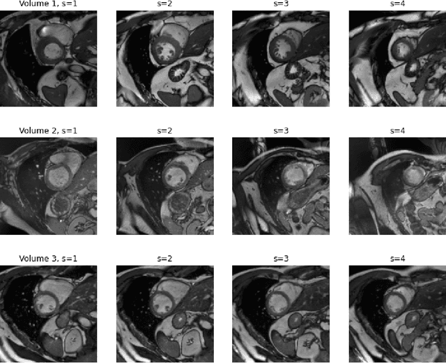 Figure 4 for Contrastive learning of global and local features for medical image segmentation with limited annotations