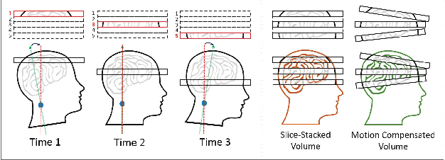 Figure 1 for Multimodal MRI Neuroimaging with Motion Compensation Based on Particle Filtering
