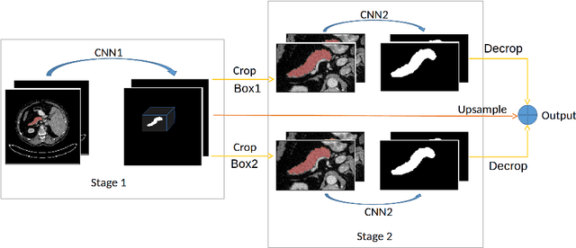 Figure 3 for Fully Automated Pancreas Segmentation with Two-stage 3D Convolutional Neural Networks