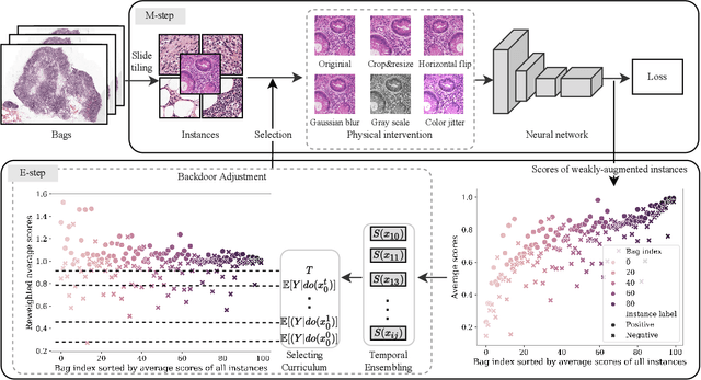 Figure 3 for Interventional Multi-Instance Learning with Deconfounded Instance-Level Prediction