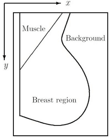 Figure 1 for Automatic elimination of the pectoral muscle in mammograms based on anatomical features