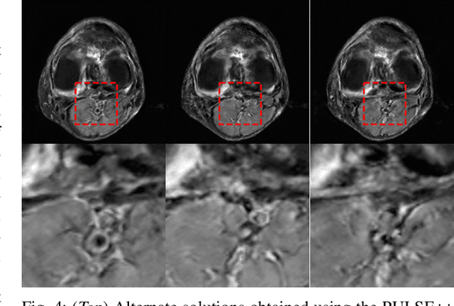 Figure 4 for Mining the manifolds of deep generative models for multiple data-consistent solutions of ill-posed tomographic imaging problems