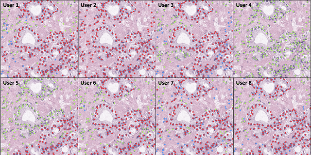 Figure 1 for Variability Matters : Evaluating inter-rater variability in histopathology for robust cell detection